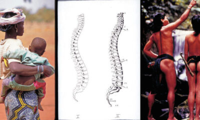 back pain indigenous cultures