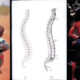 back pain indigenous cultures