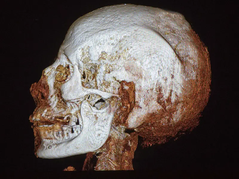 2200-Year-Old Egyptian Mummy