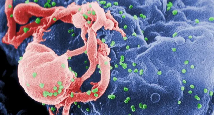 HIV Gene-Editing Therapy