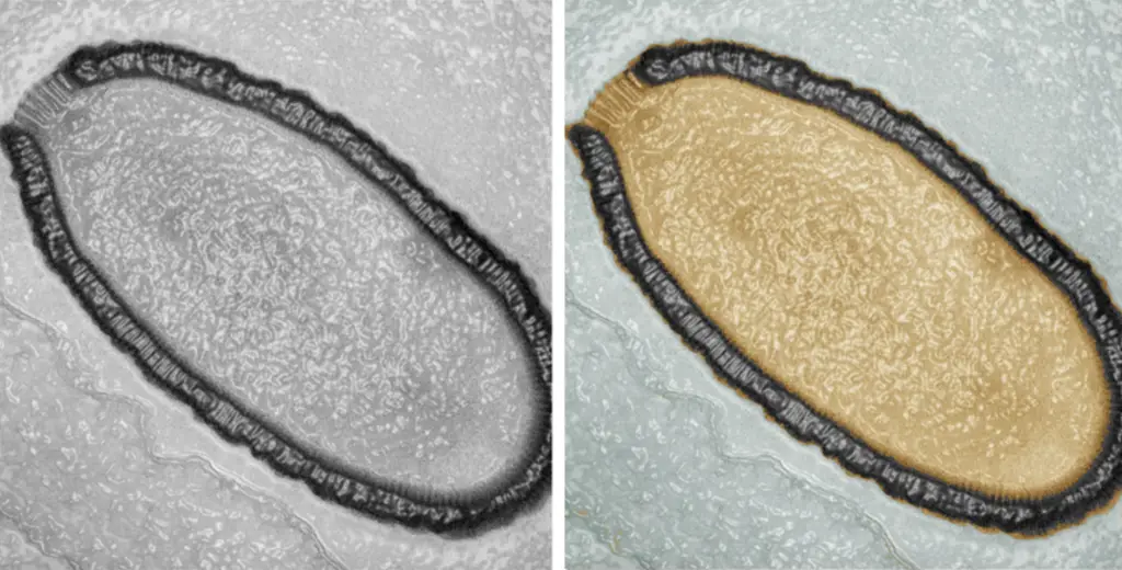 A 'Zombie' Virus Was Thawed Out And Revived in Siberia After Being Frozen For 50 Thousand Years